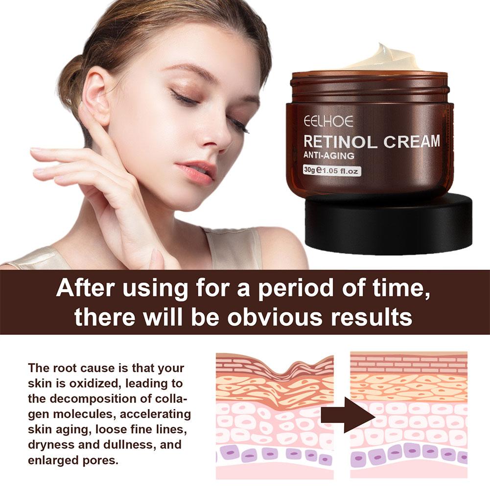 EELHOE 1/2/3/5PCS(Buy 3 Get 2  - Retinol Anti Wrinkle Cream review and price