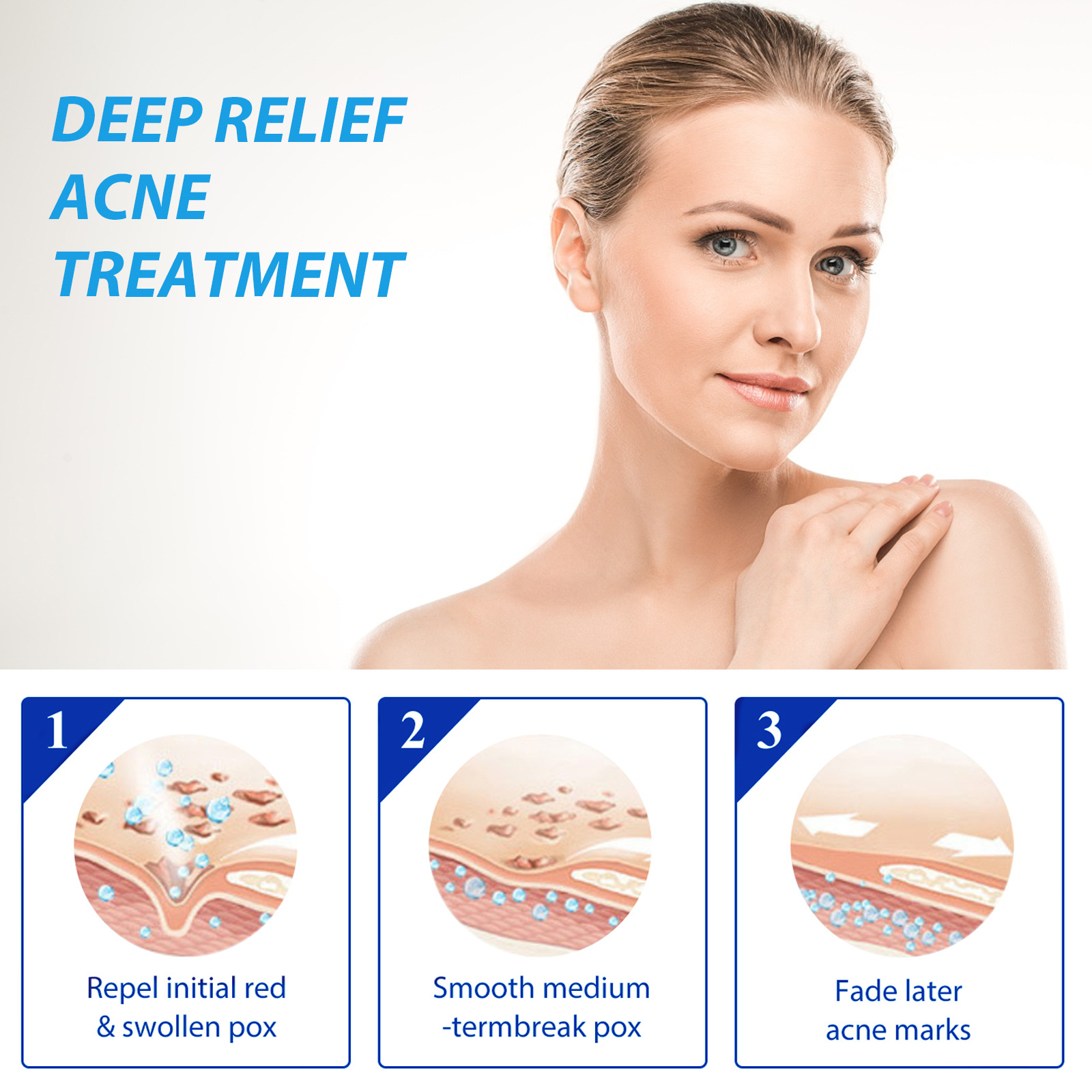 EELHOE Acne Treatment Lotion S - Salicylic Acid Blackhead Remover review and price