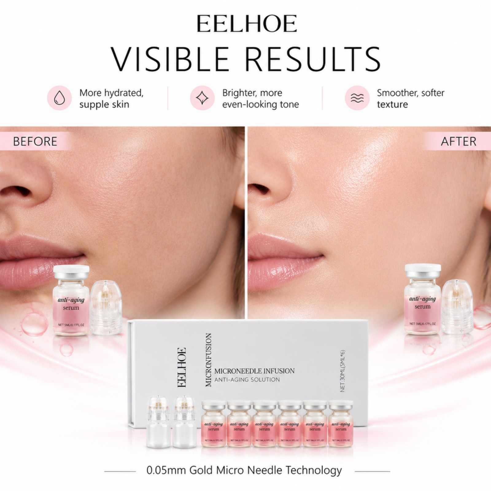 0.2mm Microneedle Serum Kit 6  - Hyaluronic Acid Facial Serum review and price